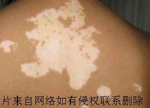 Ԥ緢ҪЩ